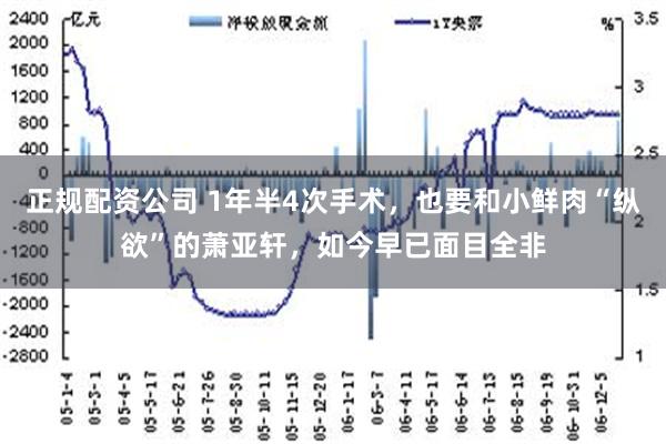 正规配资公司 1年半4次手术，也要和小鲜肉“纵欲”的萧亚轩，如今早已面目全非